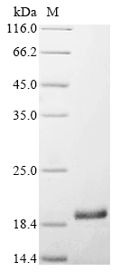 SDS-PAGE