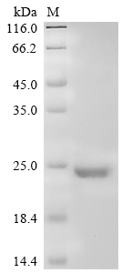 SDS-PAGE