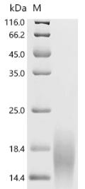 SDS-PAGE