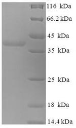 SDS-PAGE