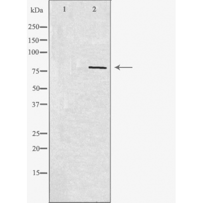 Валидация Affinity DF4378 - 15852