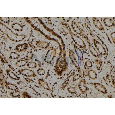 Валидация Affinity DF6318 - 17645