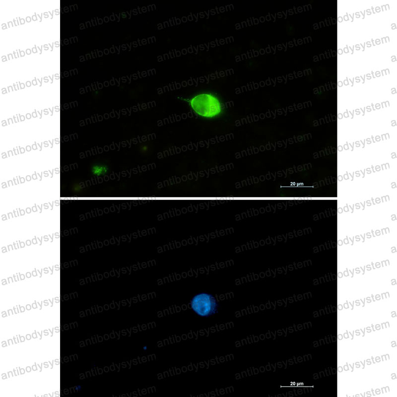 Валидация IF - AntibodySystem RHJ35301