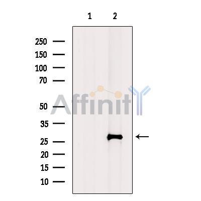 Валидация Affinity DF2493 - 13141