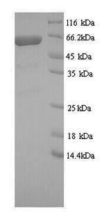 SDS-PAGE