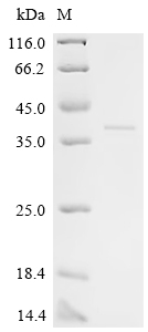 SDS-PAGE
