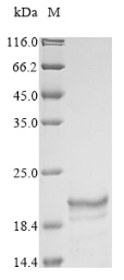 SDS-PAGE