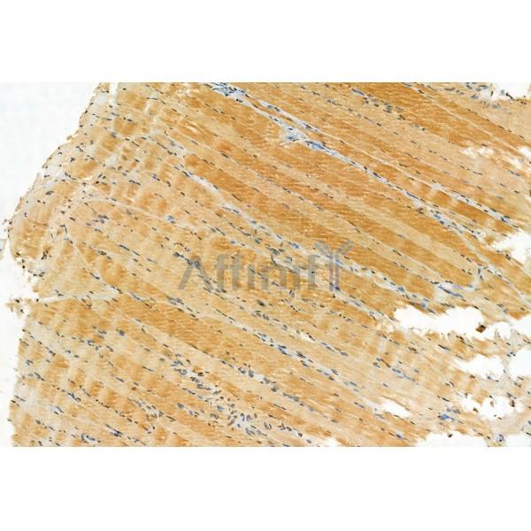 Валидация Affinity DF8427 - 20305