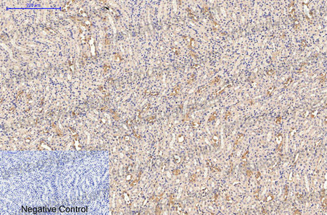 Валидация AntibodySystem RHD36801 (1526)