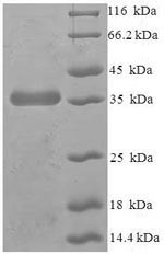 SDS-PAGE