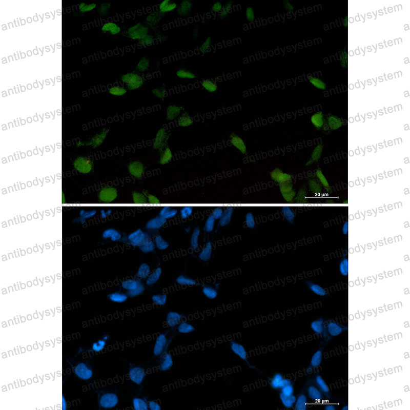 Валидация IF - AntibodySystem RHC16501