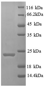 SDS-PAGE