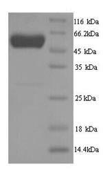 SDS-PAGE