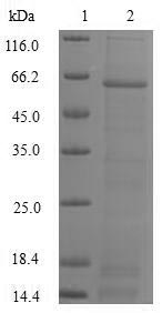 SDS-PAGE