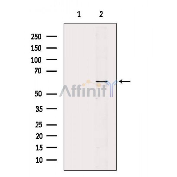 Валидация Affinity AF6451 - 3769