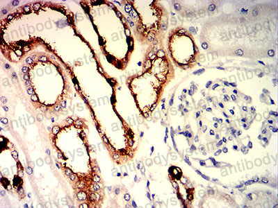 Валидация AntibodySystem RHK46102