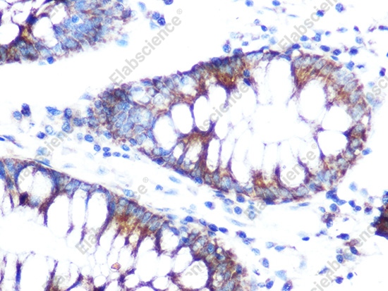 Иммуногистохимия, Folate Binding Protein, ткань толстой кишки человека