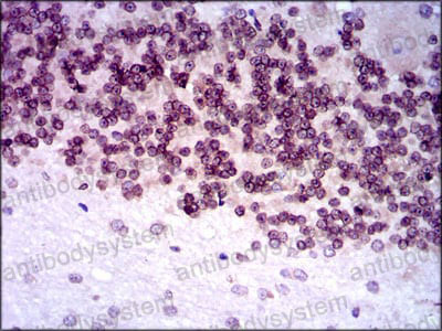 Валидация AntibodySystem RHH09101 (3169)