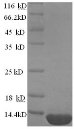 SDS-PAGE