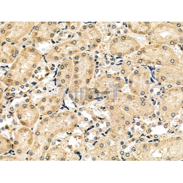 Валидация Affinity DF6154 - 17390