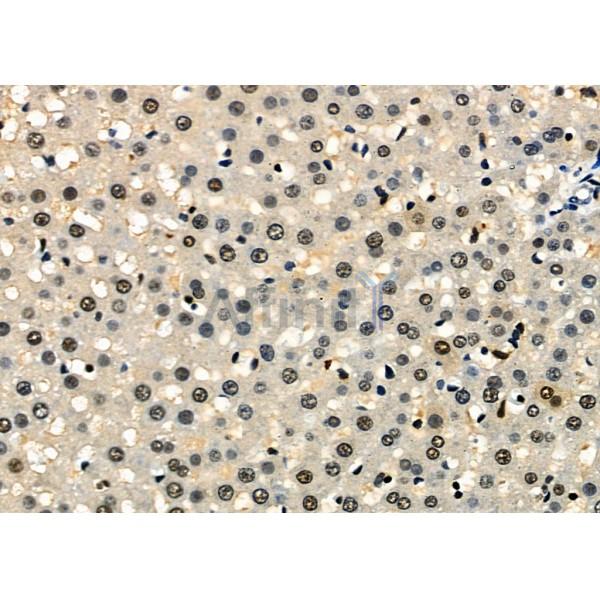 Валидация Affinity DF6272 - 17571