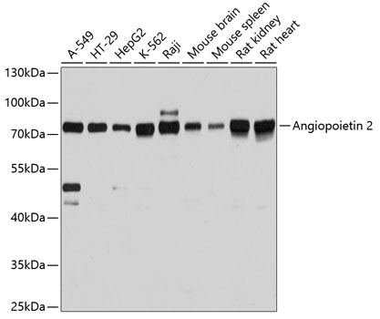 Вестерн-блоттинг, Angiopoietin 2, различные клеточные линии