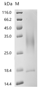 SDS-PAGE