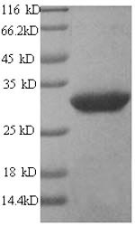 SDS-PAGE