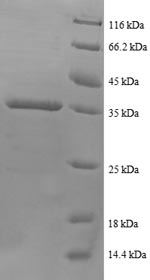 SDS-PAGE