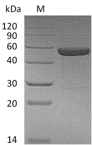SDS-PAGE