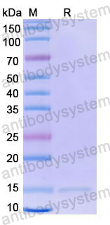 Валидация SDS-PAGE - AntibodySystem RHF02001