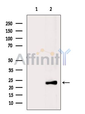 Валидация Affinity AF6879 - 4093