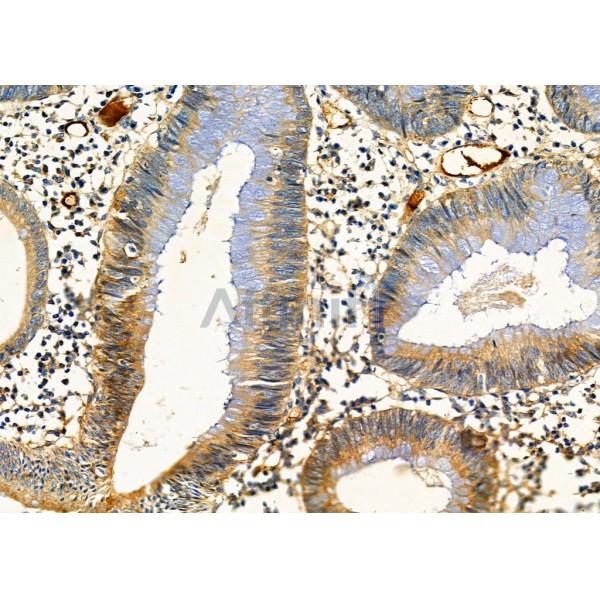 Валидация Affinity DF4918 - 16730