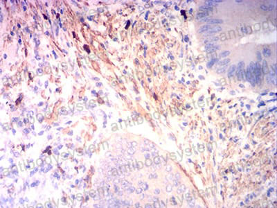 Валидация AntibodySystem RHB97303