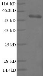 SDS-PAGE