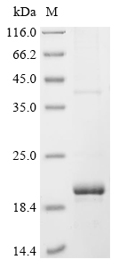 SDS-PAGE