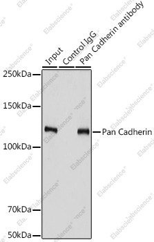 Иммунопреципитация и вестерн-блоттинг, Pan Cadherin, клетки PC-3