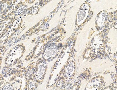 Валидация Affinity DF14828 - 10940