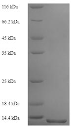 SDS-PAGE