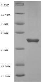 SDS-PAGE