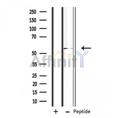 Валидация Affinity DF3644 - 14626