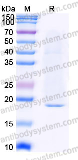 AHJ70902, SDS-PAGE