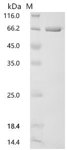 SDS-PAGE