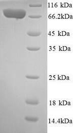 SDS-PAGE
