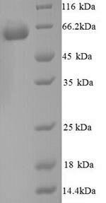 SDS-PAGE