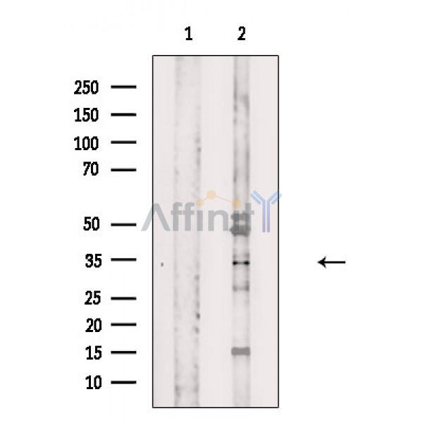 Валидация Affinity DF8694 - 20676