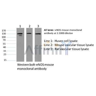 Валидация Affinity BF0705 - 5378