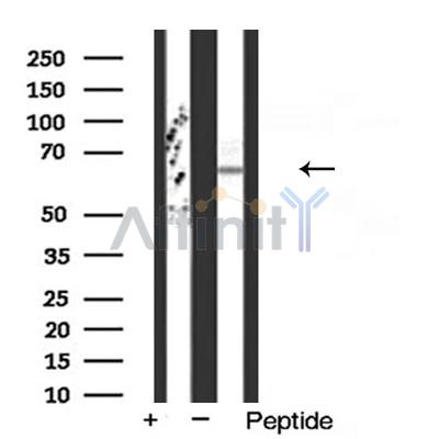 Валидация Affinity AF5282 - 2813