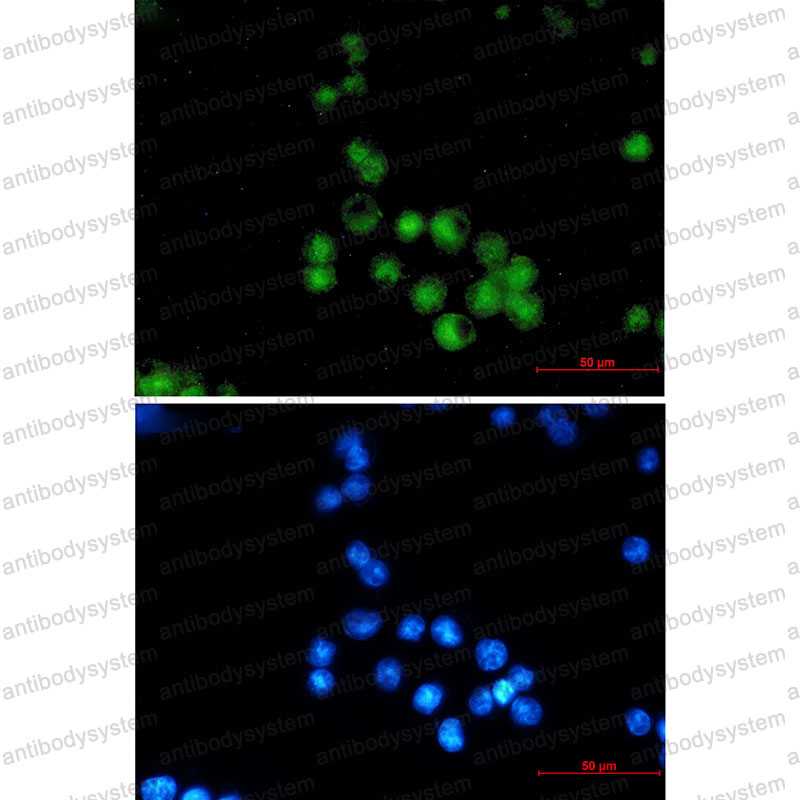 Валидация IF - AntibodySystem RHF91201
