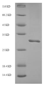 SDS-PAGE